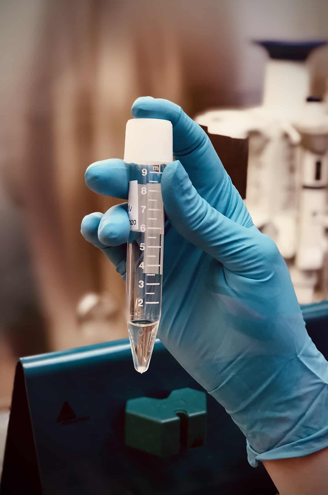 IVF- metoda MACS