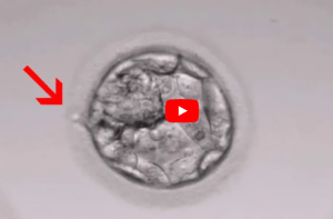 Assistiertes hatching